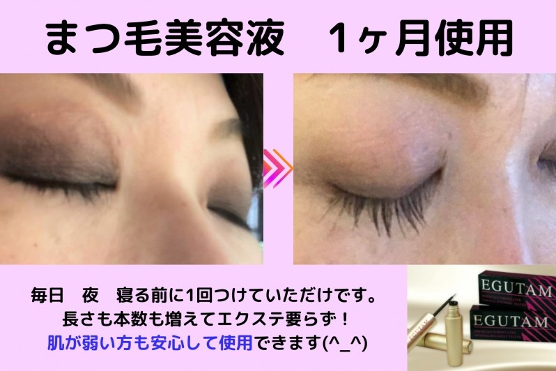 たった１～2ヶ月でまつ毛がフサフサ！敏感肌でも大丈夫なオススメまつ毛美容液